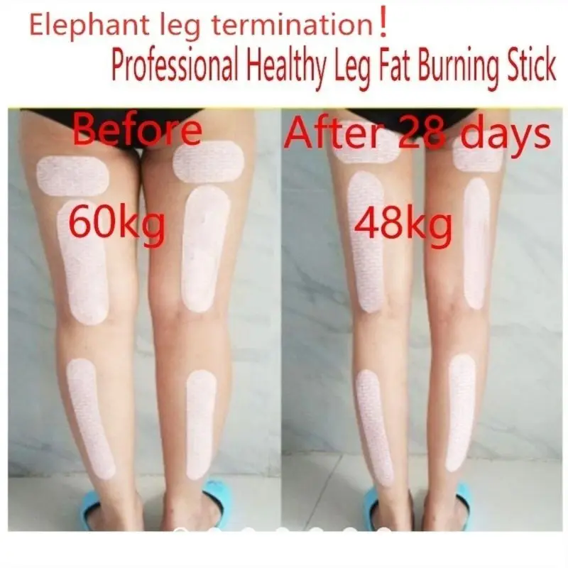 3Pcs/Set Slimming Patches Thigh Calf Leg Arm Body Shaping Stickers Weight Loss B Dropship