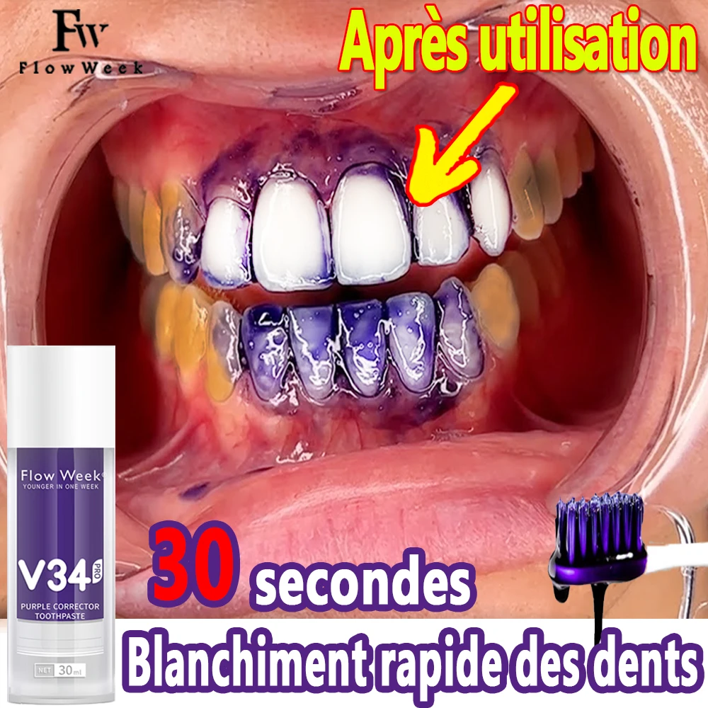 Smilekit V34 Roxo Creme Dental, Color Corrector, Dentes para Clareamento Dental, Clareamento, Reduzir Amarelecimento, Limpeza Dental