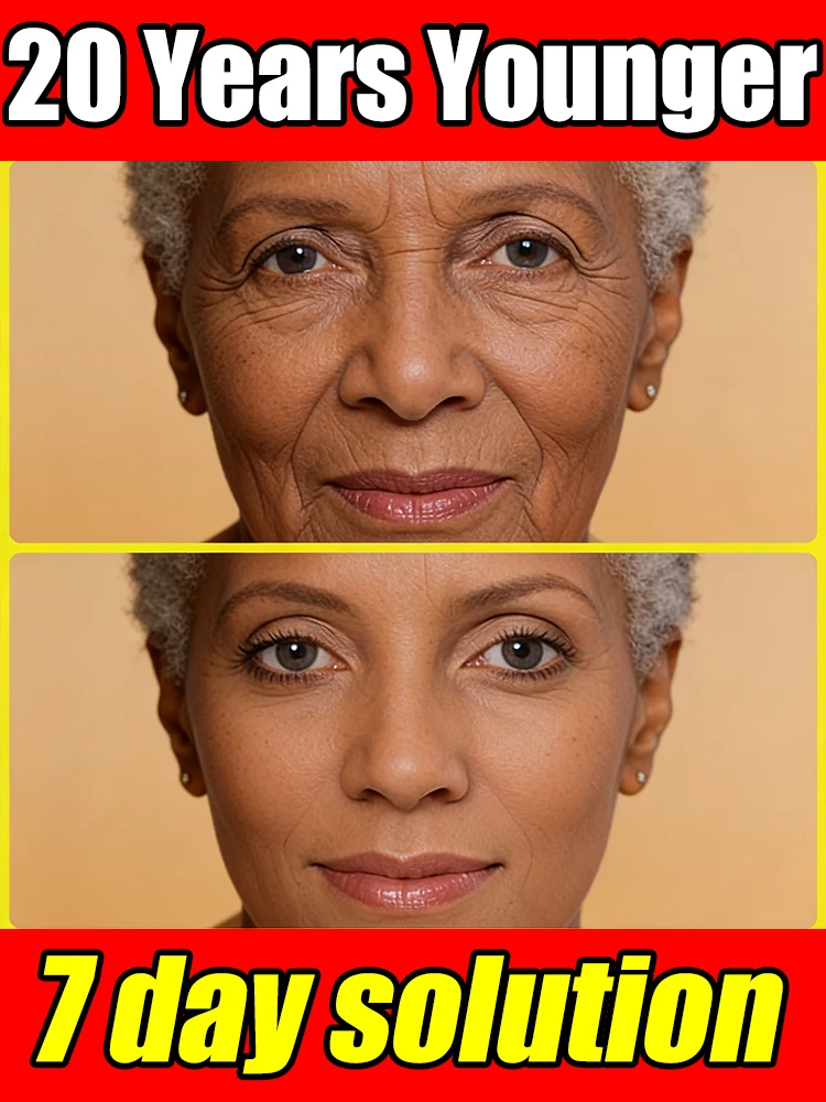 

2026 новый усиливает внешний вид кожи, 20 лет младшего возраста.