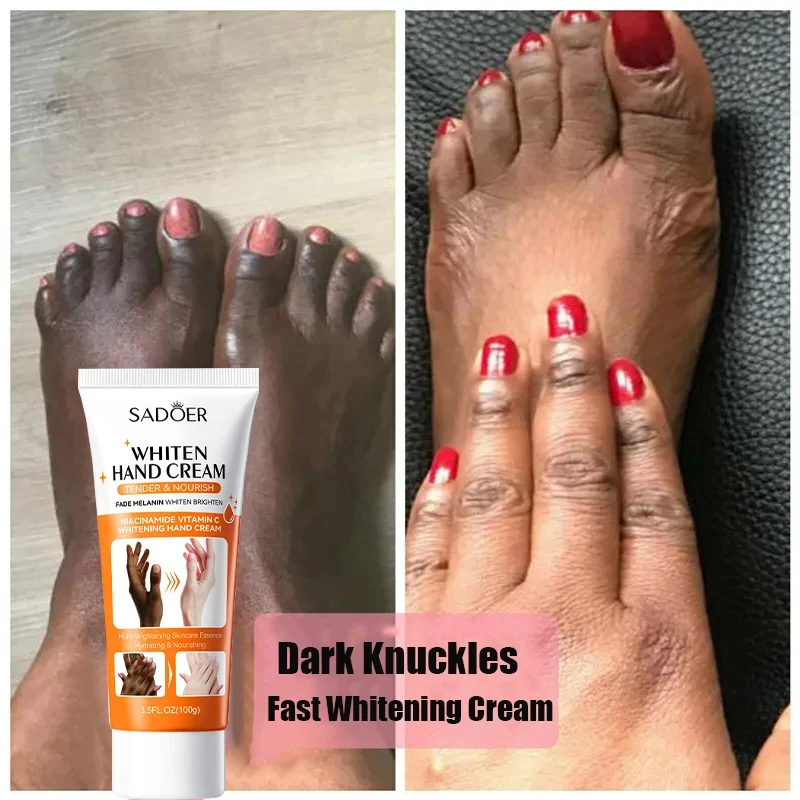 Dark Knuckles Hand Cream, Clareamento Rápido, Anti Cracking, Corretores de Pigmentação para Pele Negra, Removedor de Manchas Intenso