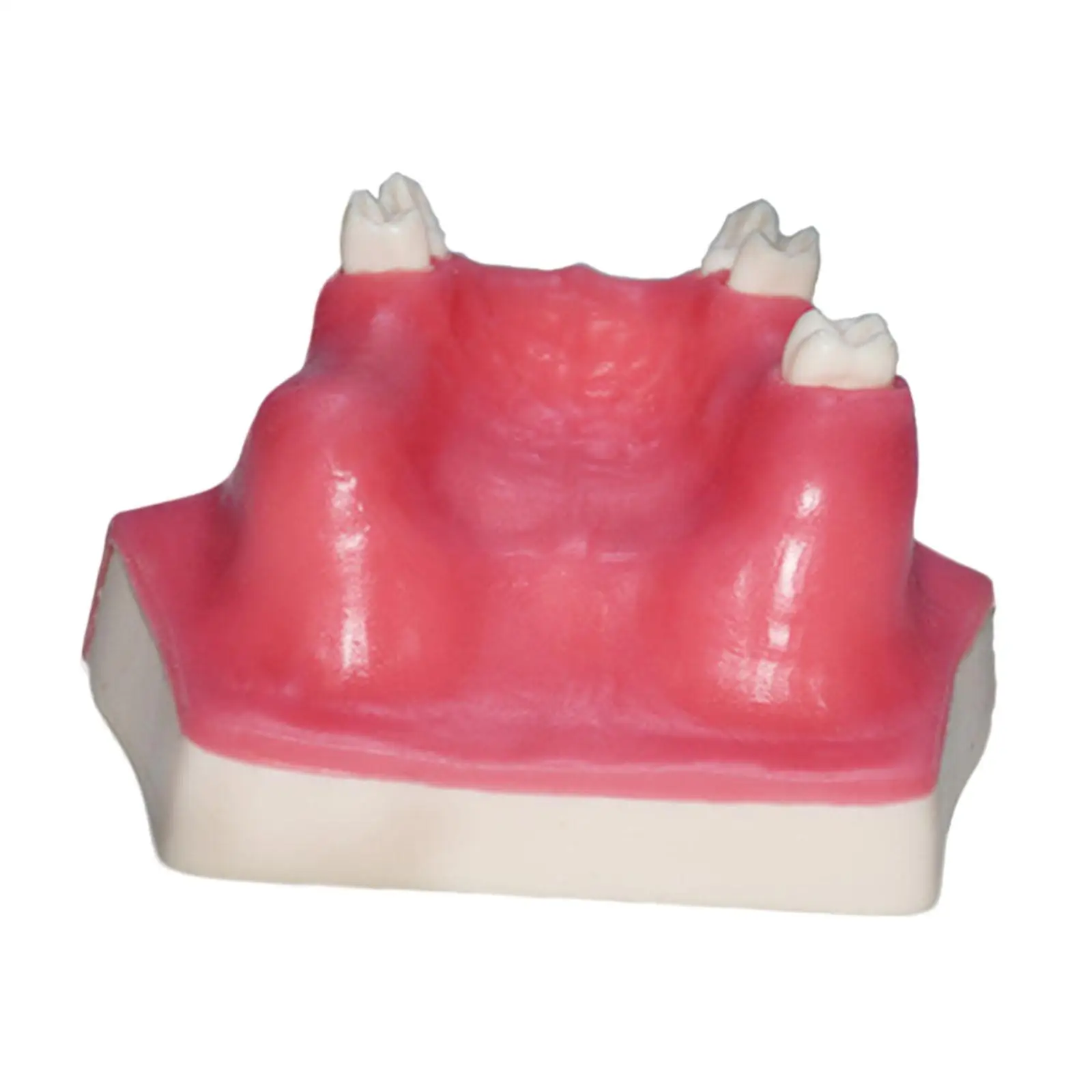 Dental Typodont Implant Tooth Model with Sinus Lift Practice Soft Gums for Maxillary Surgery Education
