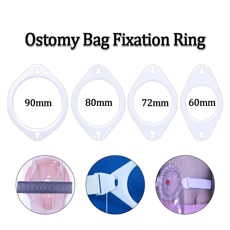 Buckle Style Ostomy Bag Fixation Ring Reinforced Colostomy Bag Stoma Bag Reinforcement Support Ring