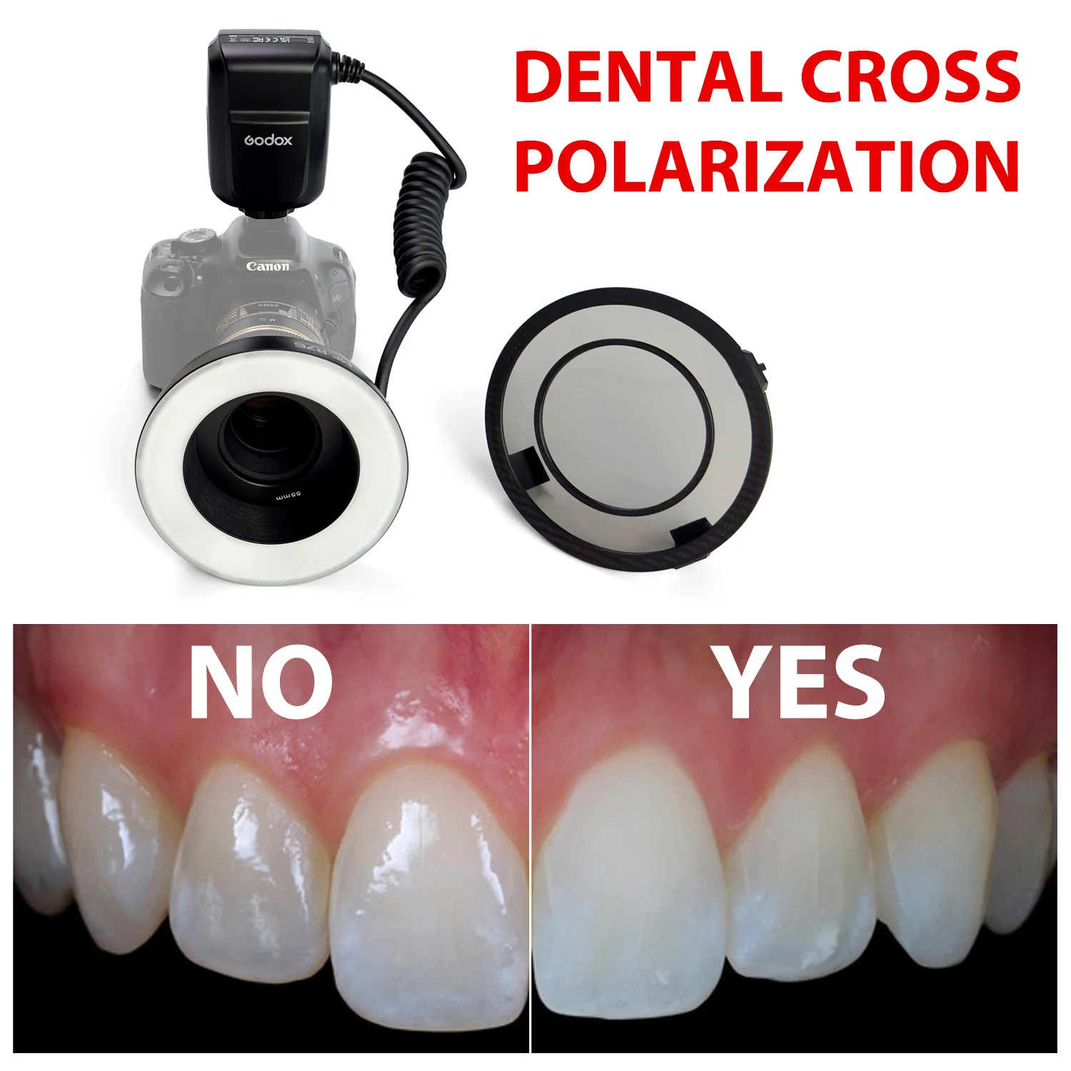 

Camera Dental Photography - No Reflection Cross Polarization Set For Godox MF-R76 Flashes. Ring Flashes Intraoral Photography