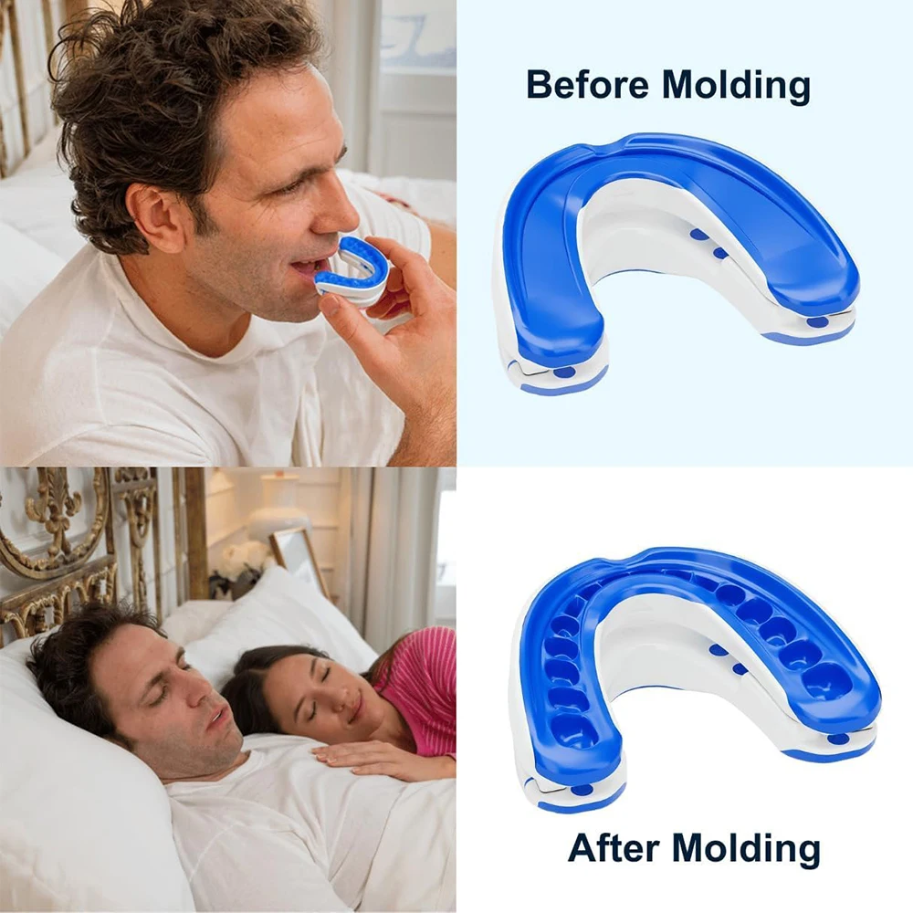 Anti-ronco bocal anti-ronco dispositivo noite tempo dentes protetor bucal ajustável dormir boca guarda para bruxismo parar de roncar