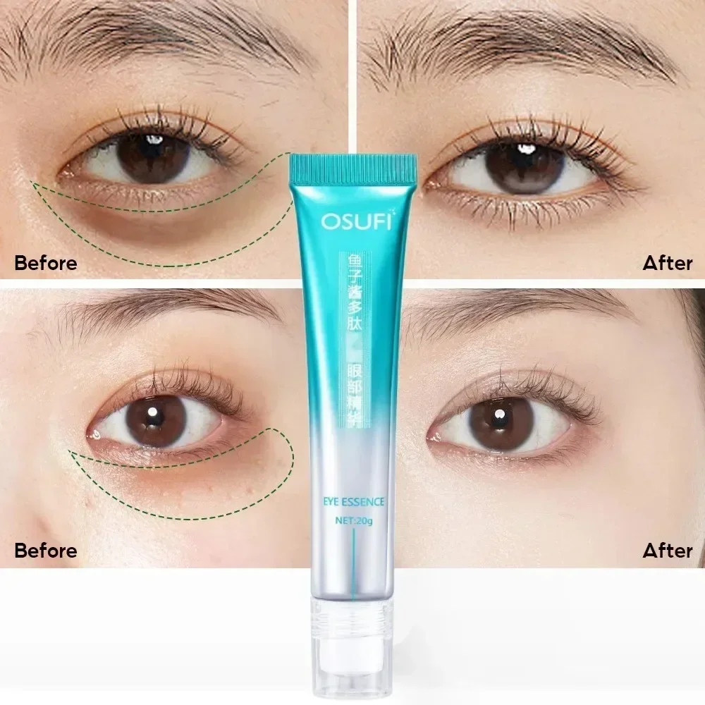 Anti-Wrinkle Dark Circles Eye cream Remove eye bags Puffiness way work under eyes Lightening Moisturizing Whitening Skin Care