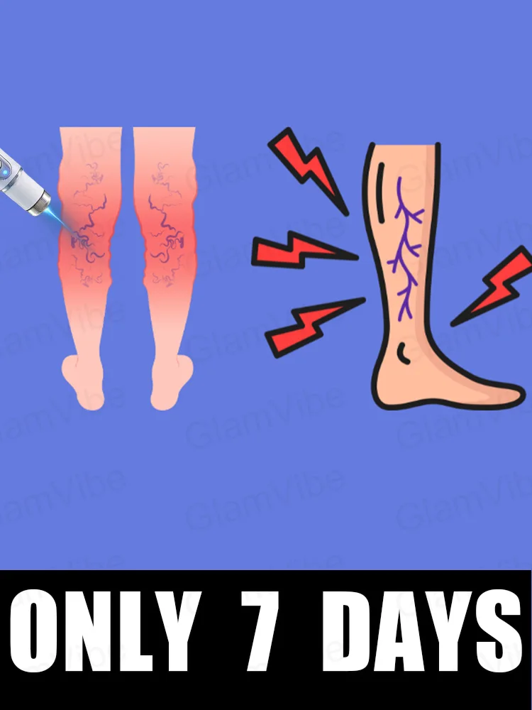 

blue light pen solve varicose veins, hot sale leg care tools