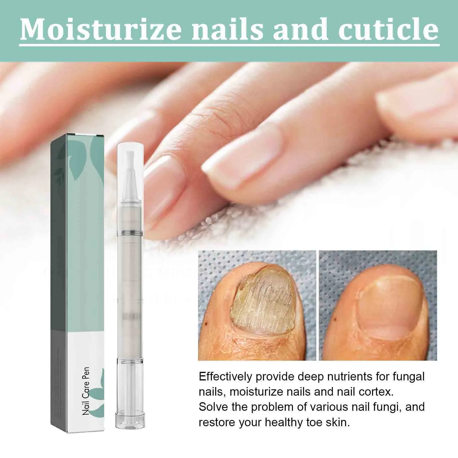 Nail TreatmentPen Nail Cuticle Oil Damaged Nail Pen Nail Strengthening Cuticle Revitalizer Oil Prevent Agnail Nail Polish