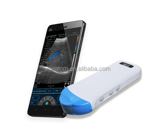 Viatom ABCDE Portable Wireless Ultrasound Scanner 192 Elements Handheld High Frequency Linear Color Wireless Ultrasound Probe