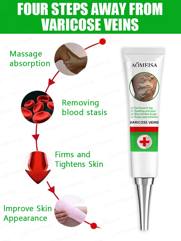 Varicose Vein Relief Gel. Relieve leg bruises