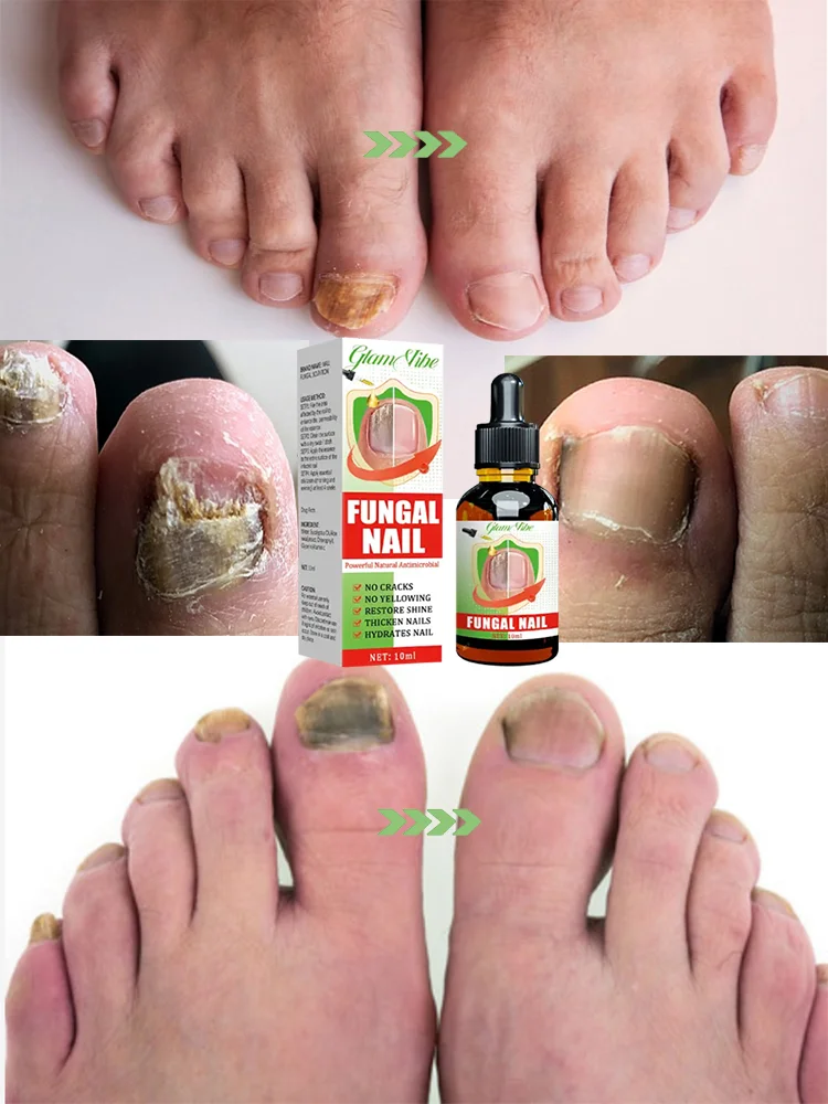 

I'll give you clean nails in seven days