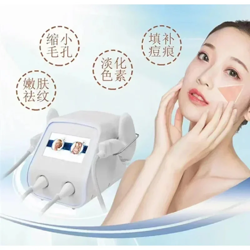 Advanced Skin Resurfacing System: Effectively Target Stretch Marks, Acne, Scars, Wrinkles & Pigmentation