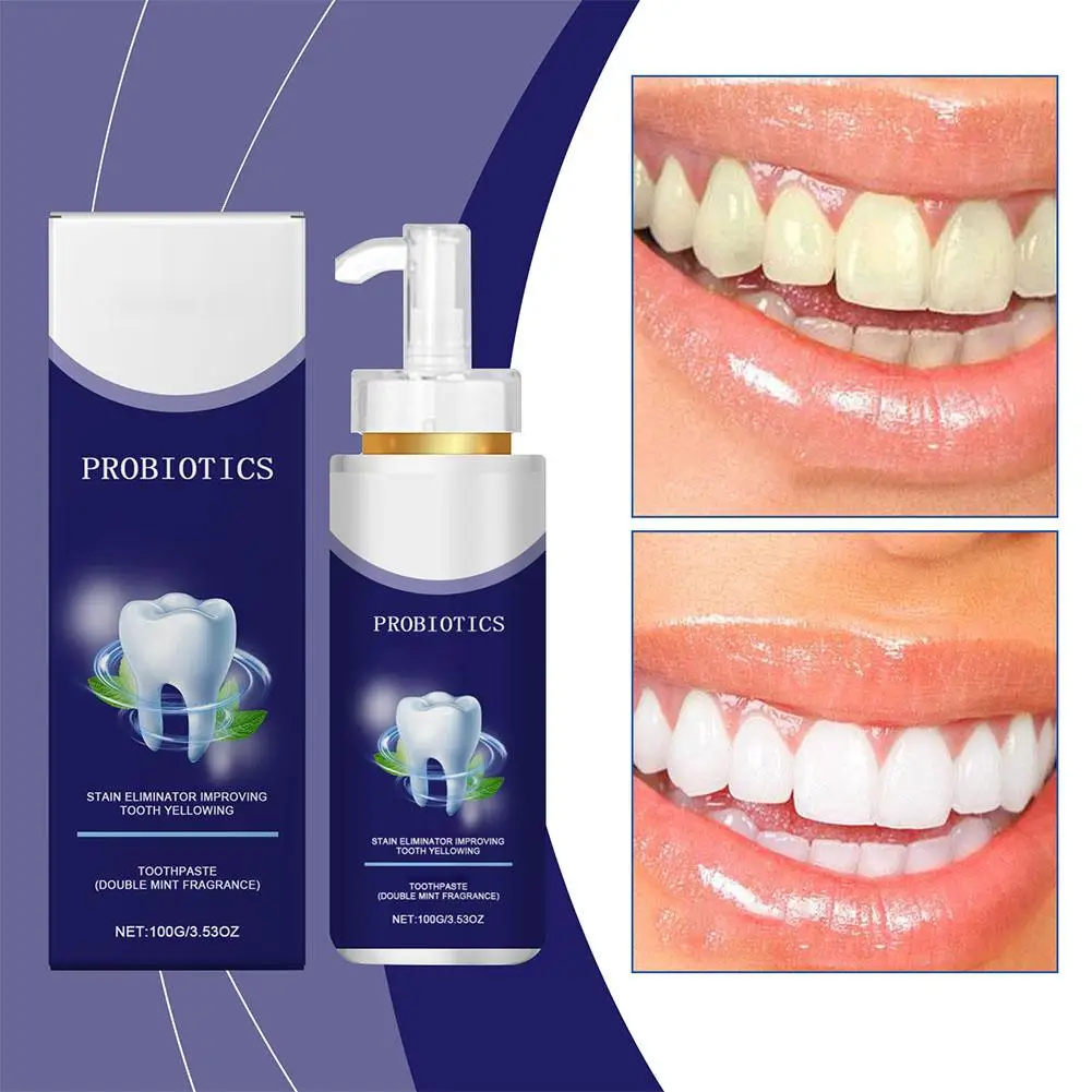 O creme dental probiótico para limpeza dos dentes, 100g, pode remover efetivamente manchas dos dentes e refrescar o hálito, produto de cuidados bucais