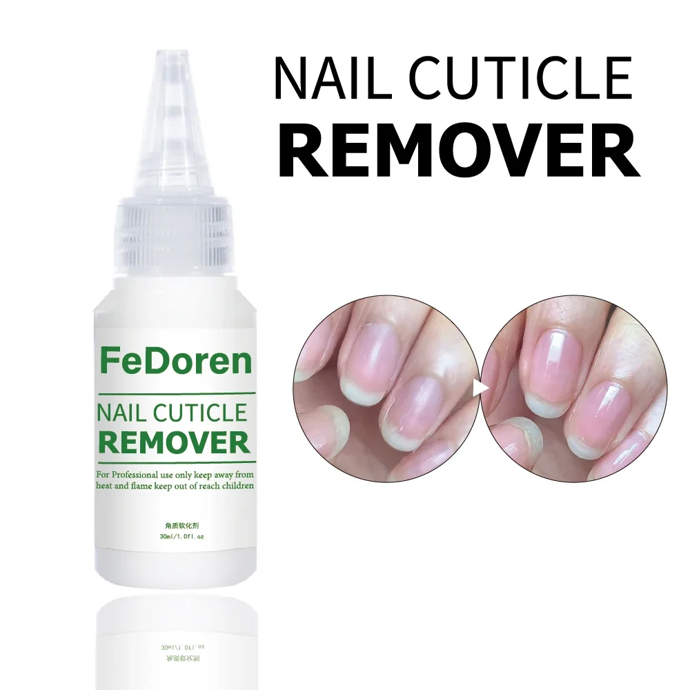 30ML Nail Cuticle Remover ammorbidente liquido per la riparazione delle unghie Gel esfoliante trattamento per cuticole Manicure ammorbidire la pelle morta per la cura delle unghie