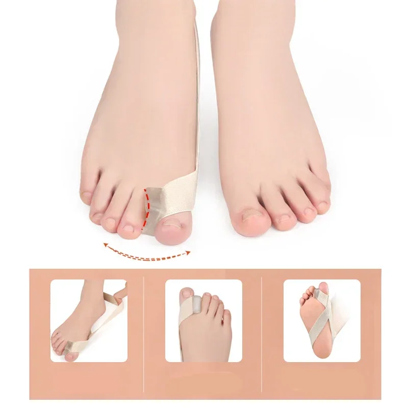 Correcteur d'hallux Valgus un côté, 1 pièce, correcteur de pouce Valgus, sangle de Tension, soulagement de la douleur, séparateur de doigts, outil de redressage des orteils
