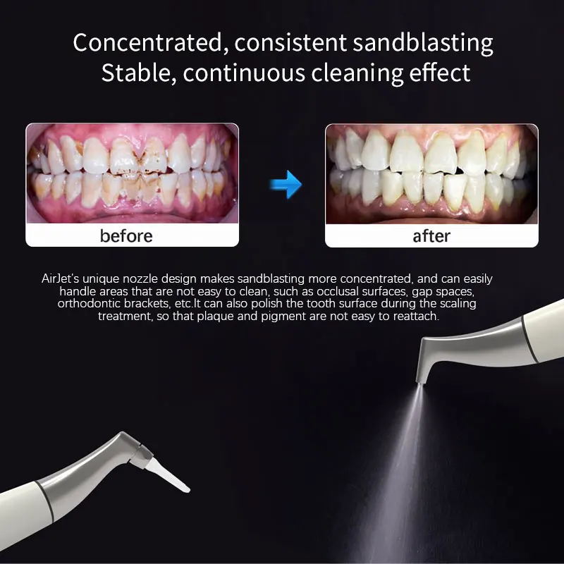 JUMTOP Dental Air Polisher Teeth Whitening Spray Sandblasting Machine, 360° Freely Rotating Handpiece