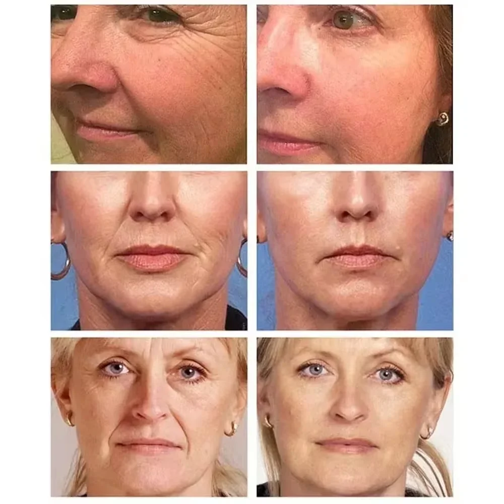 Retinol, Falten entfernen, Gesichtscreme, Lifting, Straffung, Anti-Aging, verblasst feine Linien, feuchtigkeitsspendend, erhellt die Hautpflege, koreanische Kosmetik