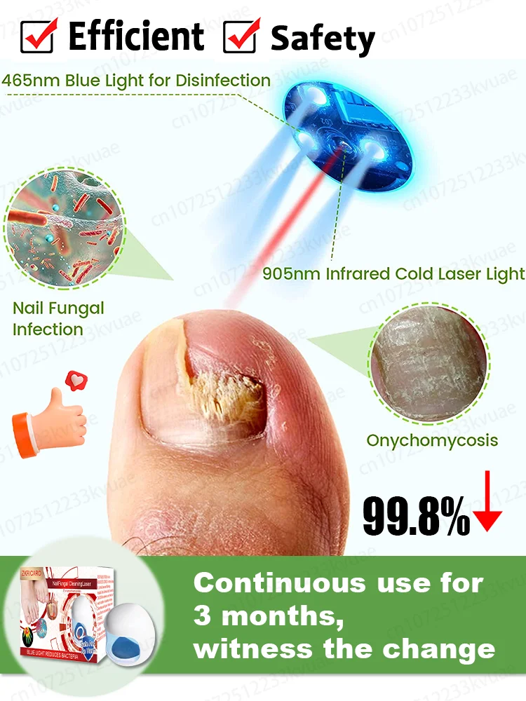 ينتج الليزر لور الحرق، إعادة تشكيل المشاكل d'ongles