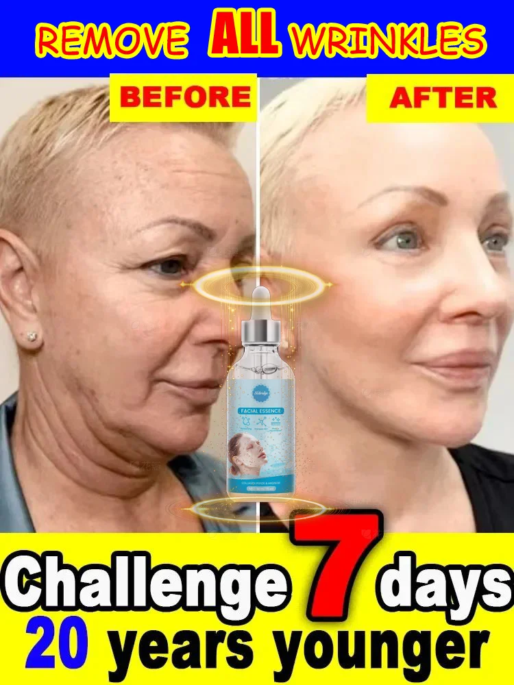

Quick Eliminate Wrinkles，Firmness Skin，Smooth Face