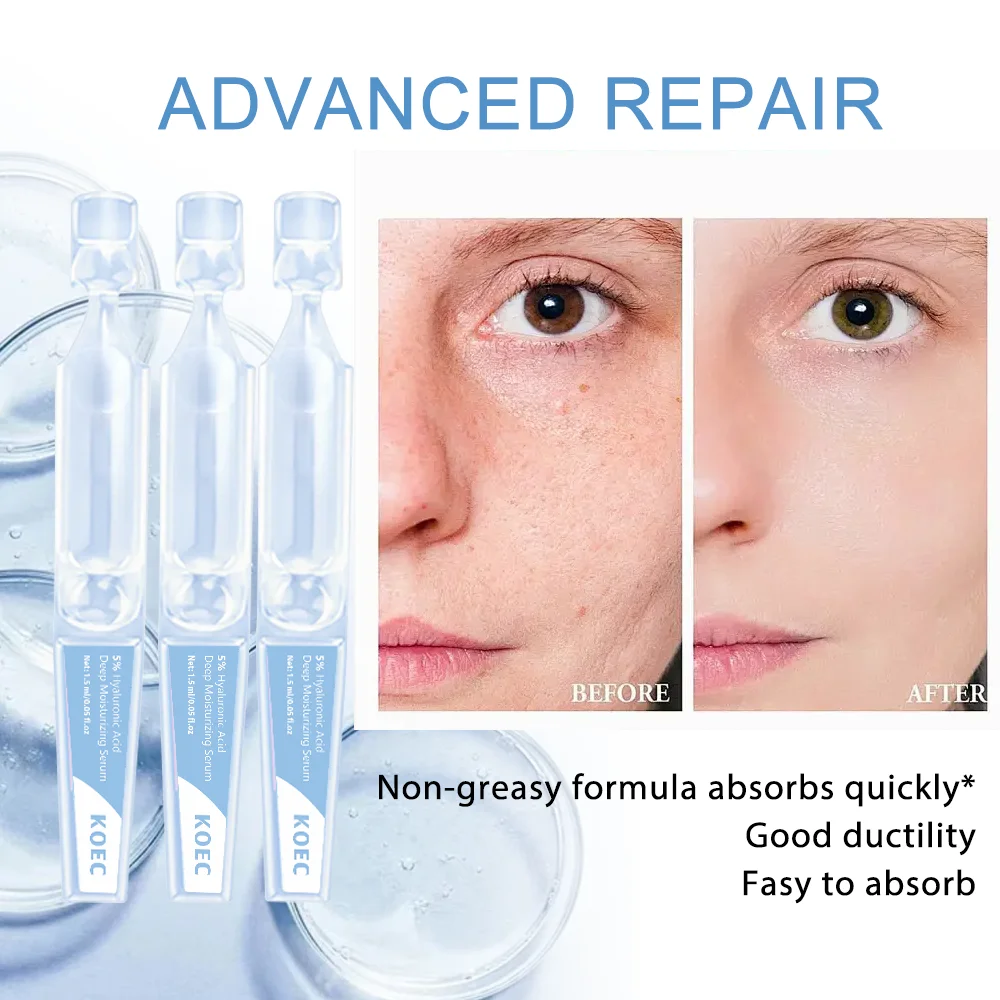 30 قطعة KOEC 5% حمض الهيالورونيك مصل ترطيب عميق للوجه فائق الترطيب إصلاح اشراق ثبات تأثير طويل الأمد