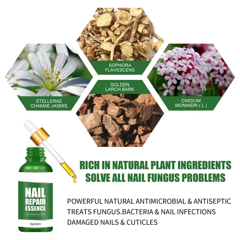 30 ml nagelbehandeling vloeibaar nagelreparatieserum, oplossing en vernieuwing van nagelschimmelbehandeling