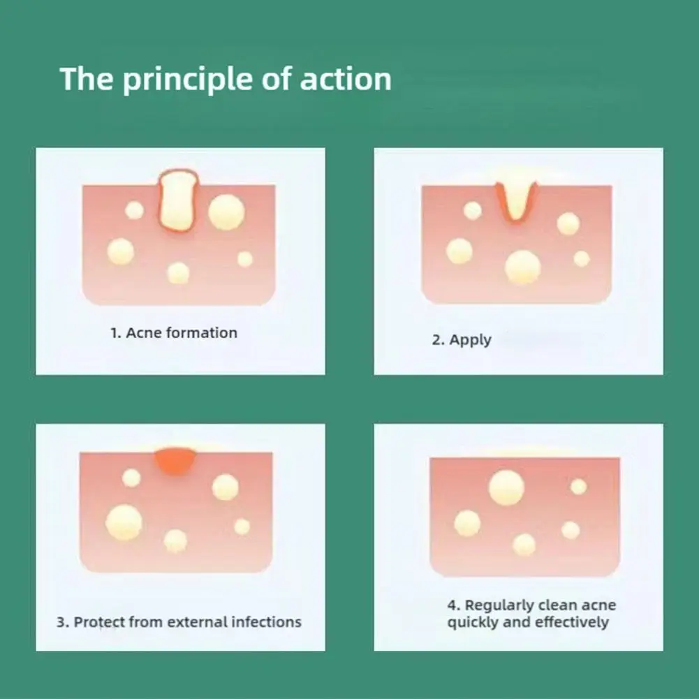 36 قطعة نجمة ملونة فراشة بثرة التصحيح حب الشباب ملصقات حب الشباب إزالة المخفي غير مرئية لبقع الوجه Zits الجمال ماكياج أداة