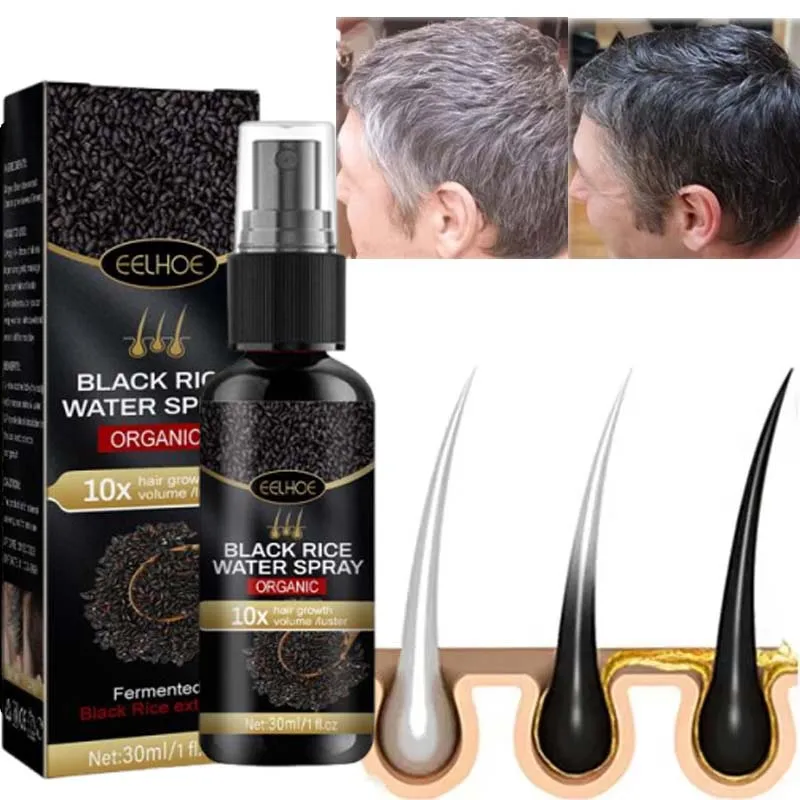 

Black Rice Hair Spray Prevent Hair Loss Promote Hair Follicle Growth Dense Hair Prevent Baldness