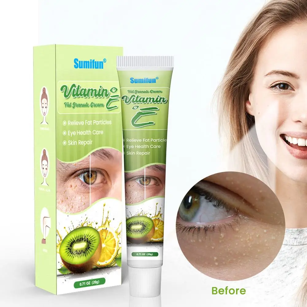 脂肪顆粒除去アイクリーム 効果的な脂肪除去製品 スキンリムーバー 抗粒子アイケア ミリア顆粒 むくみ R L4X4