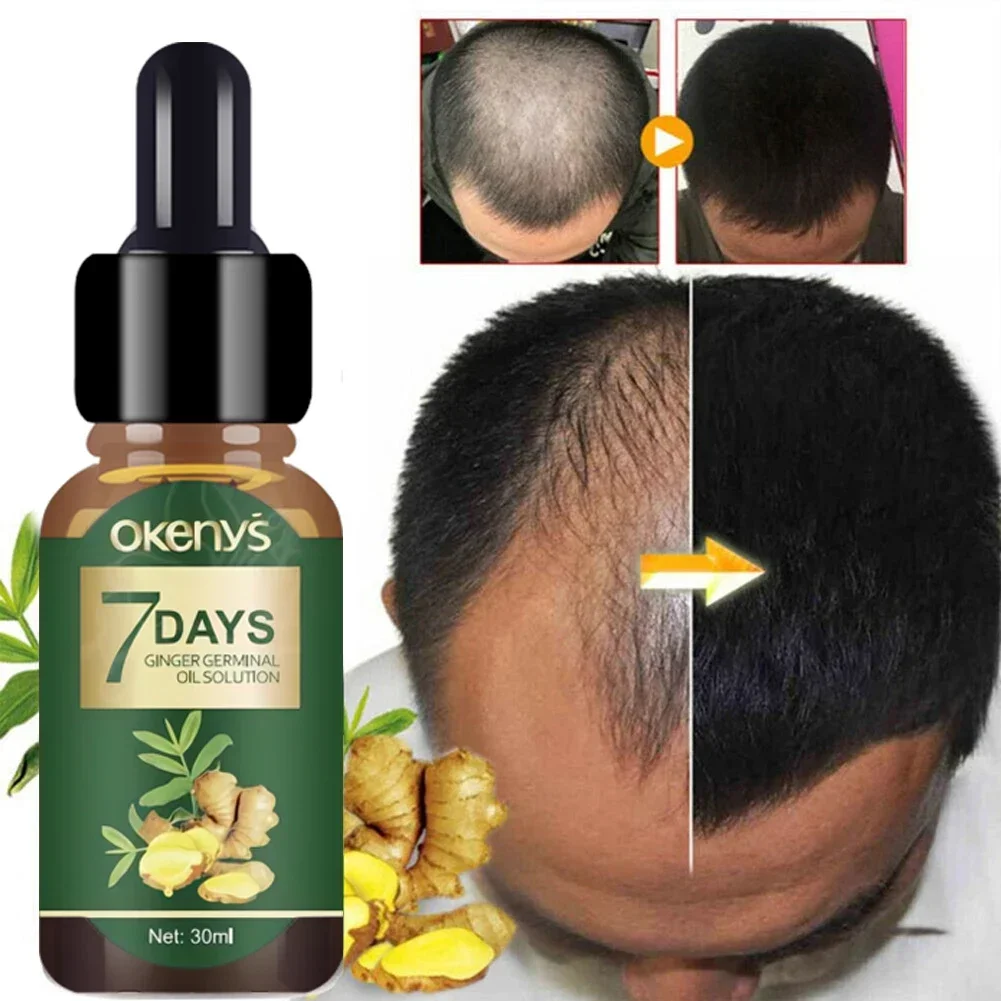 Ginger Hair Growth Essence 7 Days Germinal Hair Growth Serum Essence Oil Hair Loss Treatment Growth  for Men Women