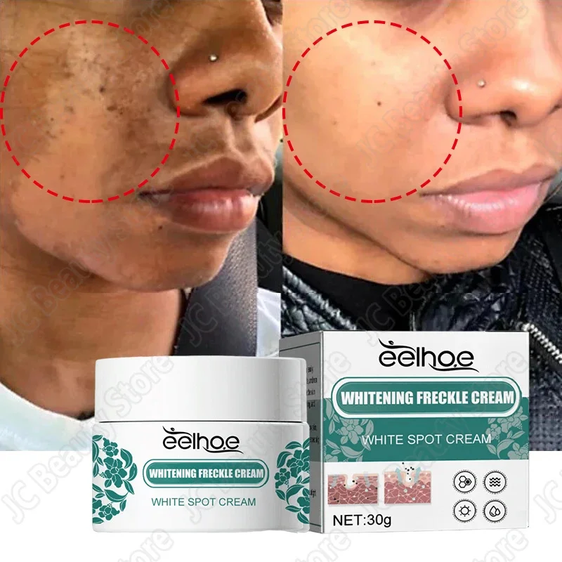 Krim Pemutih ramuan kuat penghilang bintik wajah, Krim Perawatan Wajah anti-pigmentasi menghilangkan bintik hitam Melanin memudarkan Melasma