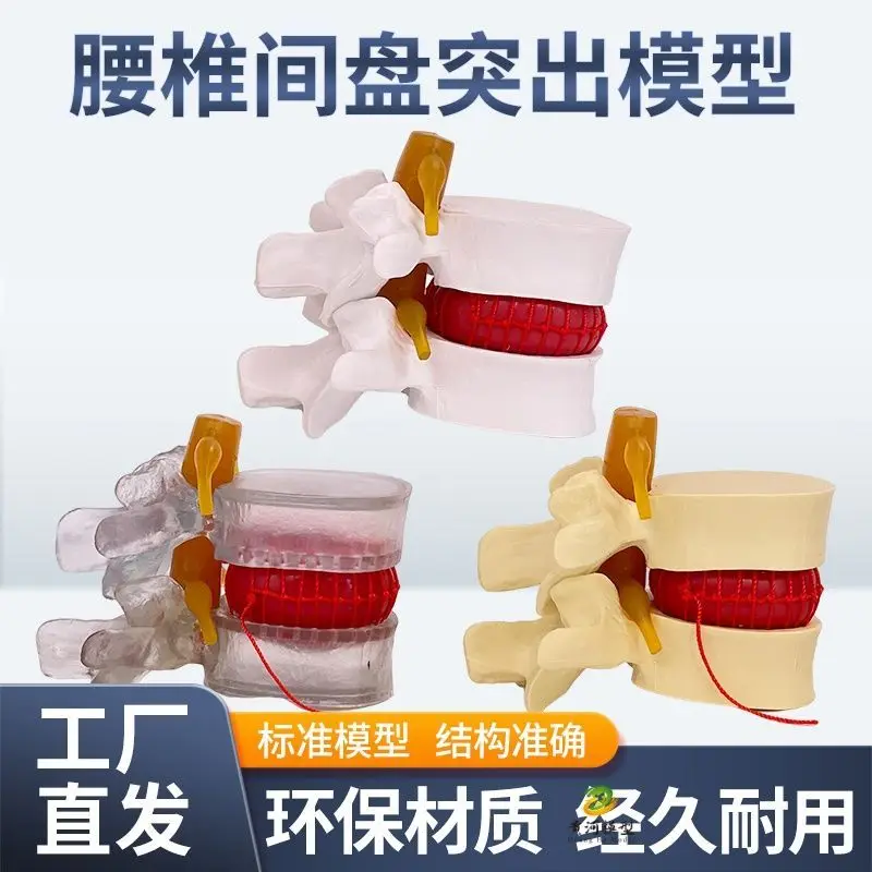 Teaching Human Spine Model Spinal Bones Lumbar Disc Mould Vertebral Herniation Compression Pathology Bone Teaching Aids