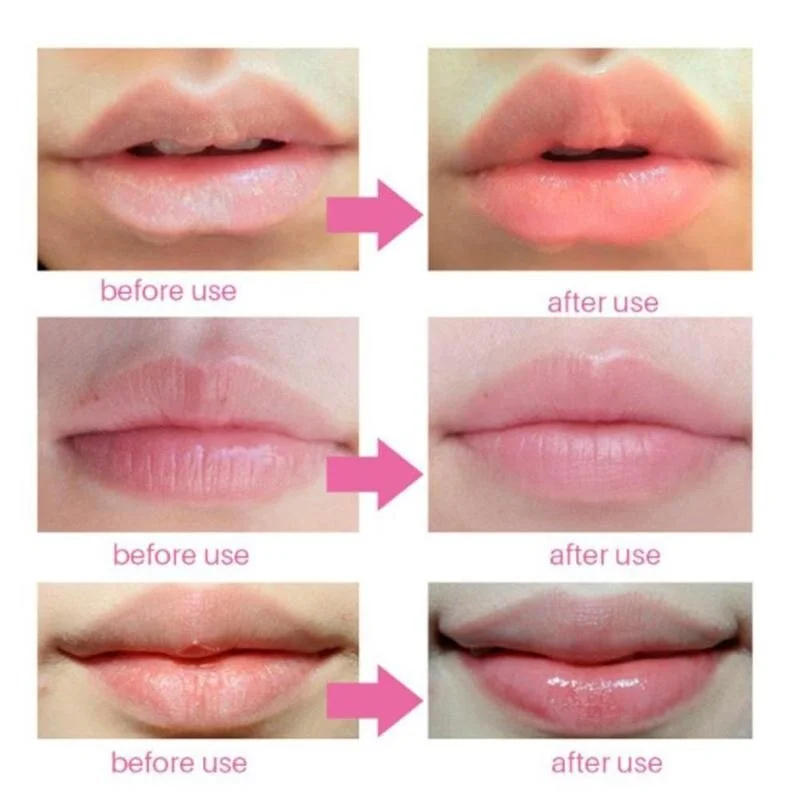 BIOAQUA Cherry Gollagen Hydrating Lip Mask Moisturizing Nourishing Anti-Drying Lightening 20pcs view 5