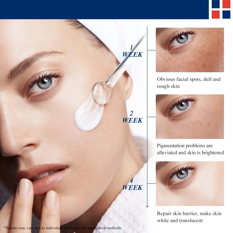 Effictive Dark Spot Remover cream for Face Removing Freckle Melasma Chloasma Senile Plaques Sunburn Cyasma Chorioplaque Freckle