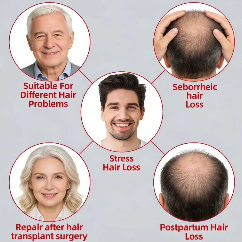 

Профессиональная медицинская беспроводная лазерная шапка с 96 диодами, терапия красным светом LLLT для стимуляции роста тонких волос, для домашнего использования