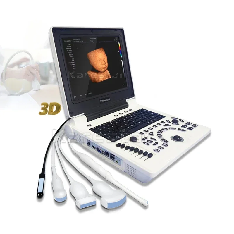 sonoscape ultrasound s9 Medical Color Doppler Ultrasound Ecografo Mindray 3d 4d Color Doppler Laptop Ultrasound