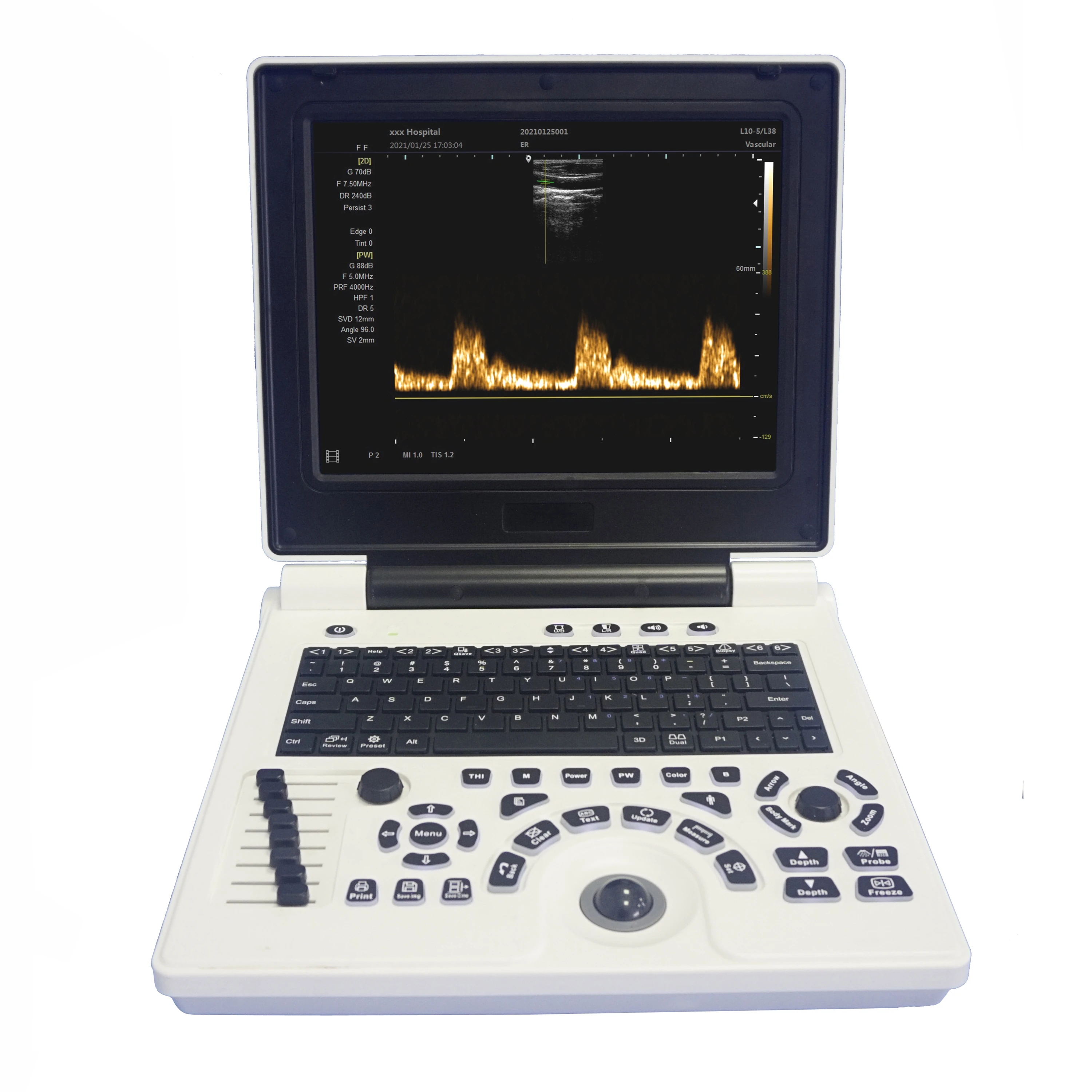 New design  s8 exp vet ultrasound machine for wholesales