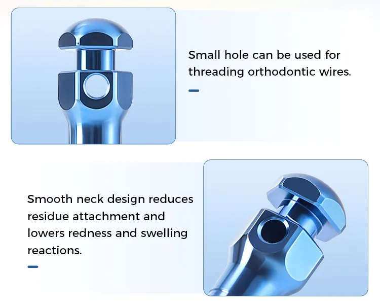 AZDENT Dental Orthodontic Mini-Schraube Sterile Titanlegierung Selbstbohrende Gewindeschrauben Implantat-Mikroschrauben Zahnmedizin – Detail 3