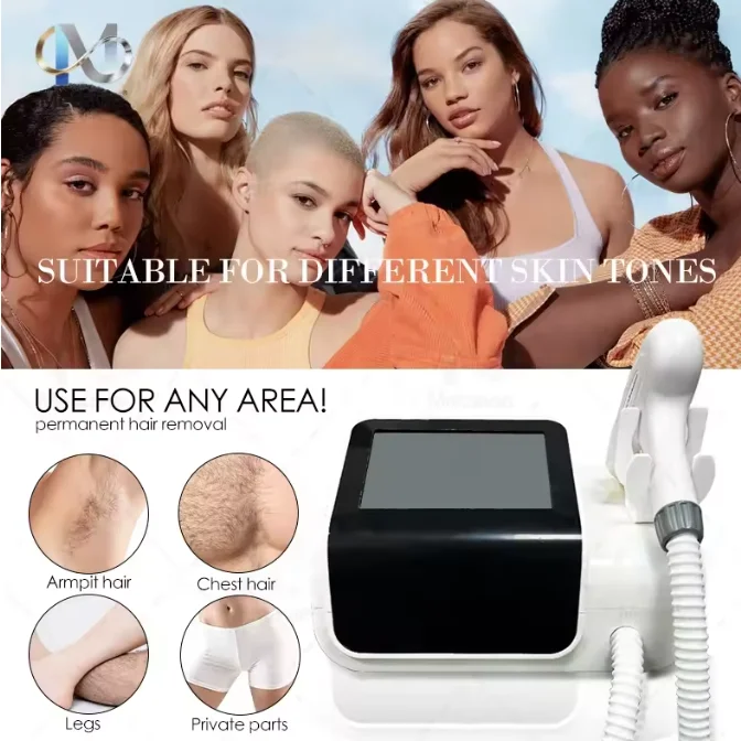 

Новейшая технология 2026 года: диодный лазер 808 нм, миниатюрный дизайн и ультрапортативность, 4 длины волны (755+808+940+1064 нм) для безболезненного удаления волос