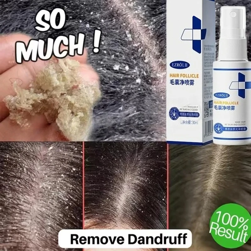 

Hair Treatment Remove Dandruff Relieve Essence Spray Prevent Loss Serum Control Smooth Nourish Repair Hair Scalp Care Products