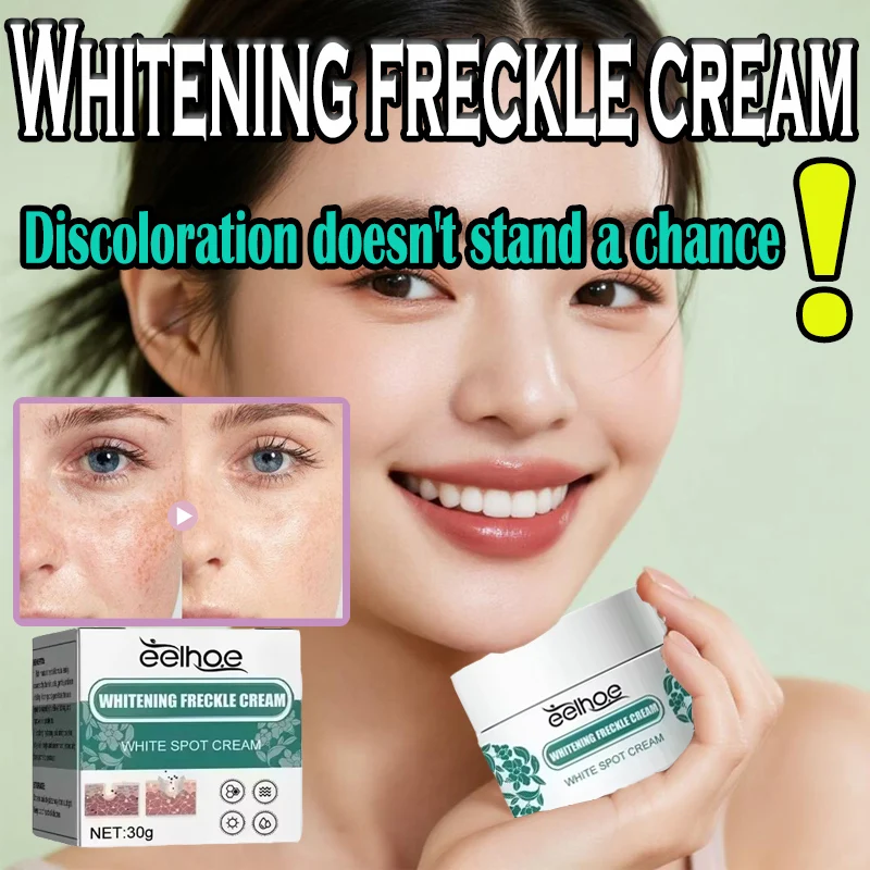 EELHOE نيكوتيناميد النمش كريم مزيل الكلف كريم إزالة التصبغ ترطيب مصل إزالة البقع الداكنة