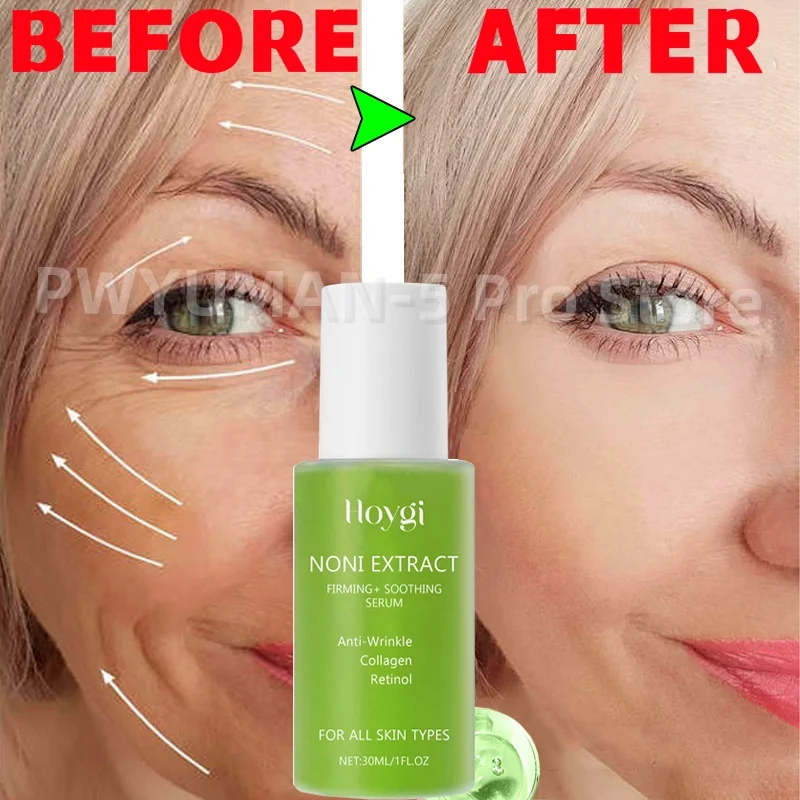 Noni Serum Wajah ekstrak Noni, ampul wajah ekstrak energi Korea Anti Keriput melembabkan gigi halus untuk semua kulit