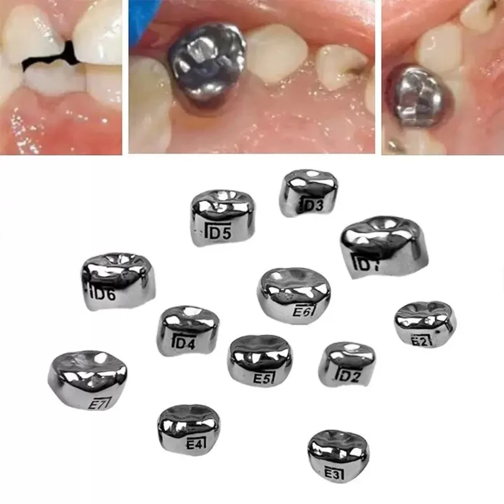 48pcs Dental Temporary Kids Crowns Primary Molar Crown Stainless Steel 1st 2nd Preformed Pediatric Dentistry Tool