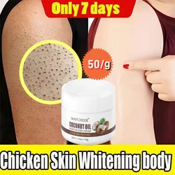 50g Keratosis Pilaris crema riparatrice pelle di follicolo di pollo rimuovi corpo macchia scura lozione per il corpo liscia idratante sbiancante pelle opaca