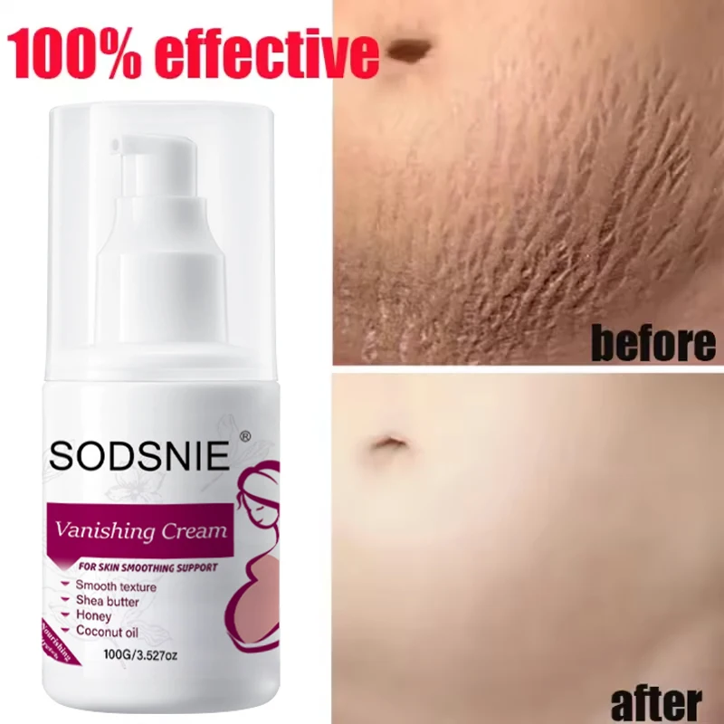 

100g Remove Pregnancy Stretch Marks Cream Shea Butter Improves Elasticity Smoothing Nourishing Moisturizing Firming Skin Care