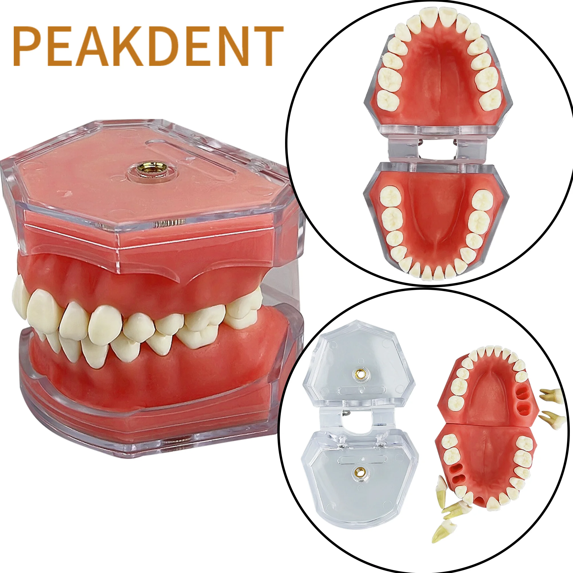 Transparent Dental Model Tooth Root Visible Dental Typodont Model With Removable Teeth Medical Students Research Study Model