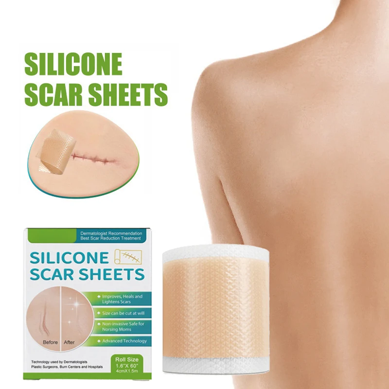 150/300 cm riparazione della pelle Gel di Silicone cicatrice foglio Patch trattamento rimozione nastro Acne Trauma bruciare cicatrice sezione bellezza dell'orecchio