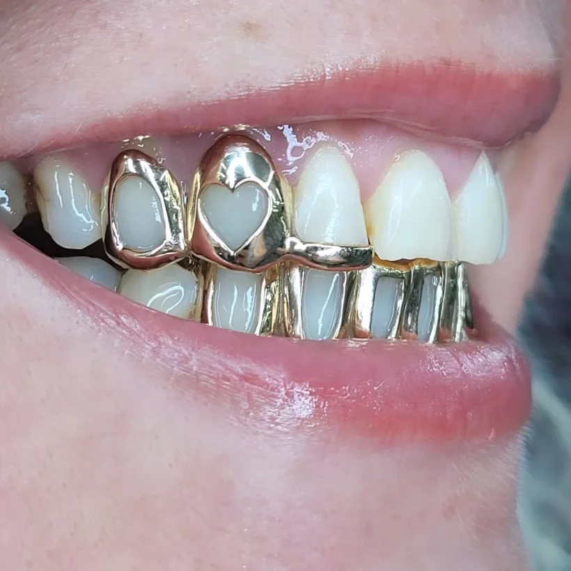 Set Of 2 Hip-Hop Style Grillz Featuring a Heart Design, Equipped With 6-Toothed Hollow Grillz,  Suitable For Both Men And Women