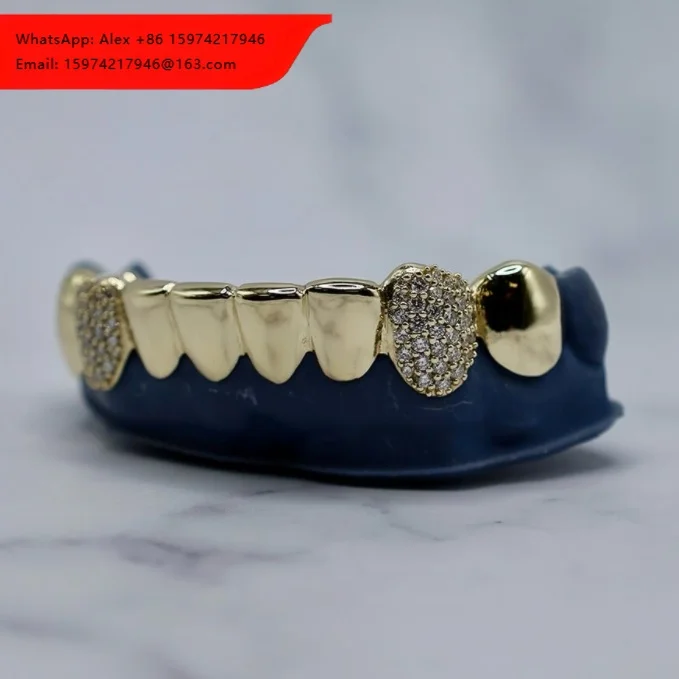 Rapper Grillz 1 Teeth Lab Grown Diamond Grillz Moissanite Iced Out Top And Bottom 10K 14K 18K Yellow Gold Grillz