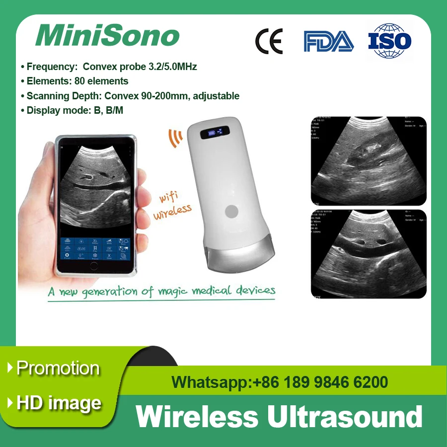 

Handheld ultrasound probe 80E Convex Wireless probe,OB，B/W version， WIFI connect