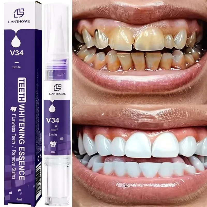 Magical Teeth Whitening Pen Effectively Removes Dental Plaque Coffee Stains Smoke Stains Freshens Breath Teeth Whitening Care