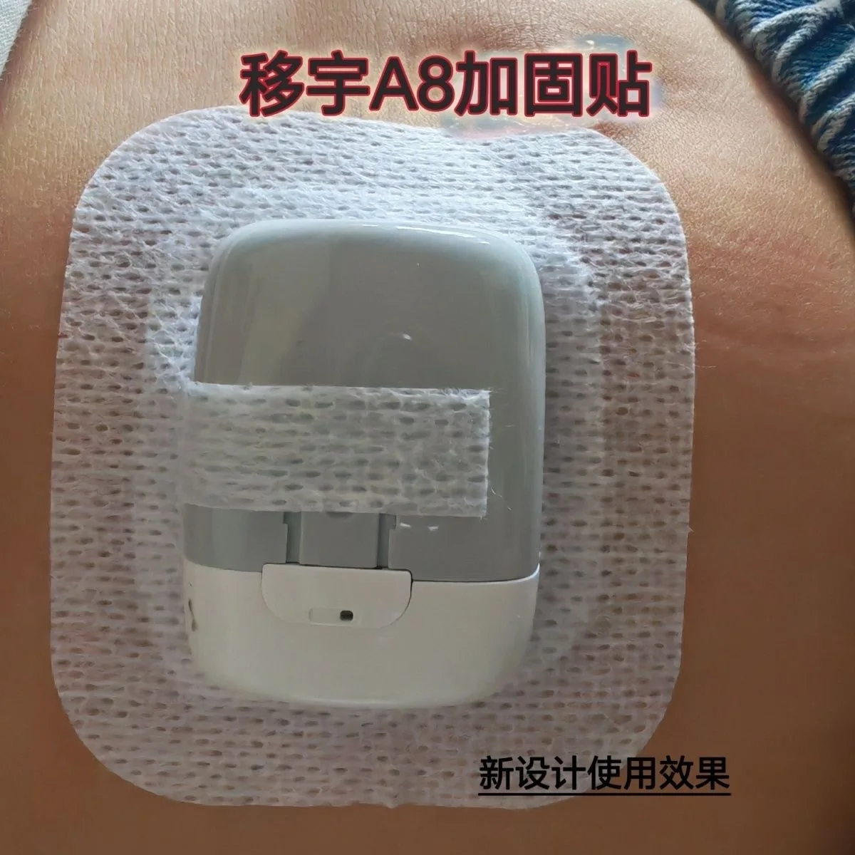 

20 шт. укрепляющей ленты для хранения лекарств Medtrum A8, расширенная антиаллергенная лента, укрепляющая лента 200u